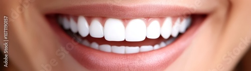 Close Up of Woman s Perfect Smile with White Teeth