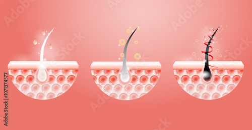 Hyaluronic acid before and after hair and skin solutions ad. collagen serum