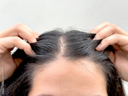 Women with hair loss dryness and frizziness