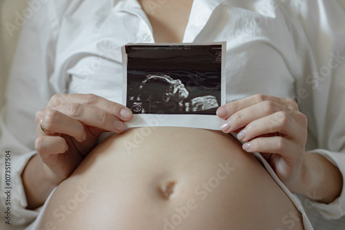 fetal ultrasound, Prenatal ultrasound screening. A woman is holding an ultrasound image in her hands photo