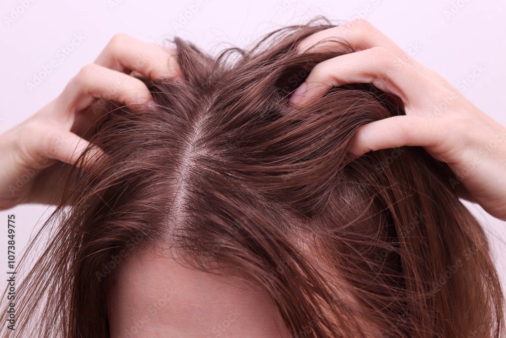 Woman scratches her scalp and hair. Dirty and greasy hair. Hair problem concept. Woman scratches her scalp and hair. Dirty and greasy hair. Hair problem concept.