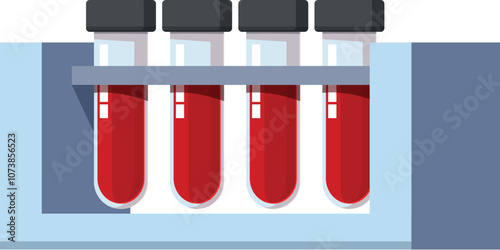 Medical blood samples are being analyzed in a laboratory setting, emphasizing healthcare and diagnostics