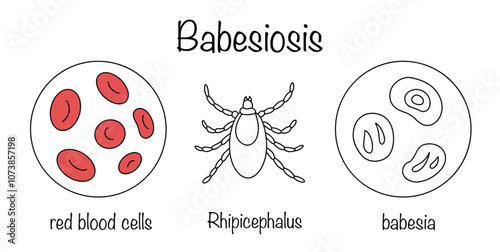 Babesiosis