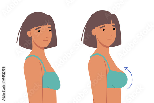 Woman had plastic surgery for breasts, inserting implants to increase size or improve firmness. Comparison of two girls before and after breast surgery and lifting of sagging nipples