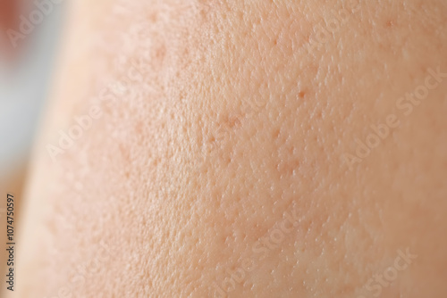 Human skin texture