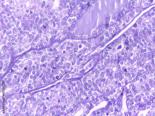 Microscopic Tissue Analysis in Purple Staining photo