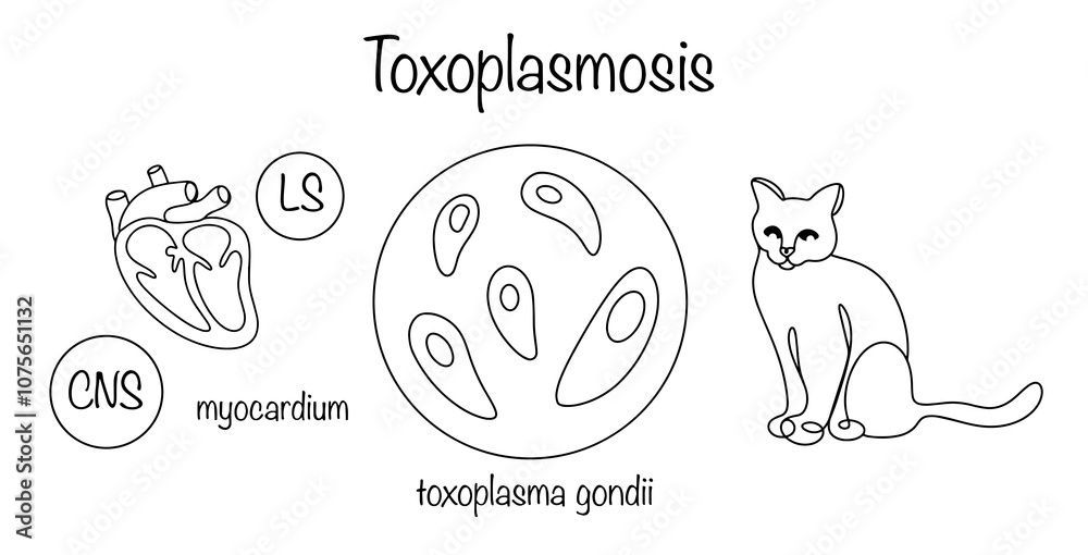 Toxoplasmosis