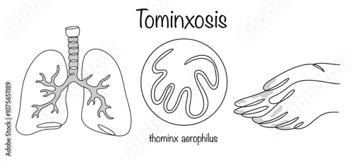 Tominxosis