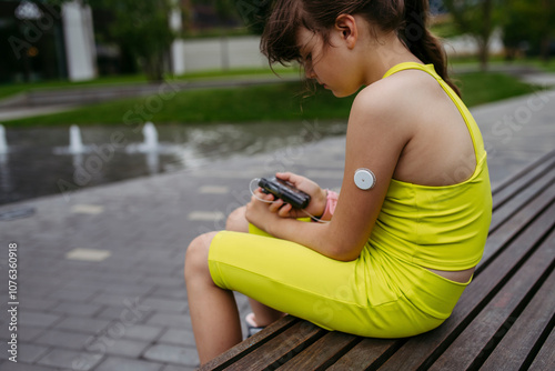 Girl with diabetes checks her blood sugar level on an insulin pump, wearing a CGM sensor