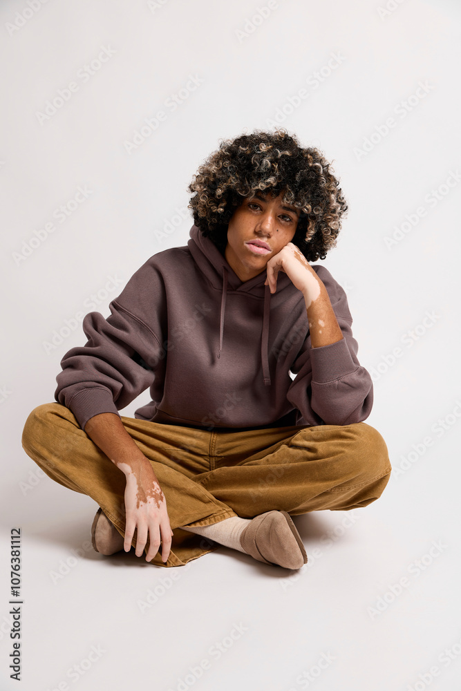 Young woman with vitiligo sitting cross-legged against white backdrop Young woman with vitiligo sitting cross-legged against white backdrop
