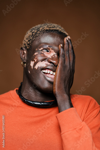 smiling young man with vitiligo, wearing an orange shirt and touching his face, revealing a joyful expression against a warm brown background highlighting his unique skin tone and cheerful personality photo