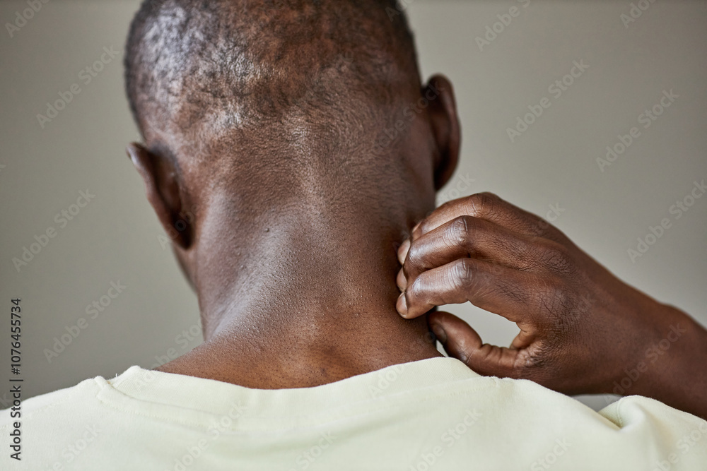 Naklejka premium Close up back view of adult African American man scratching neck suffering from skin condition or anxiety copy space