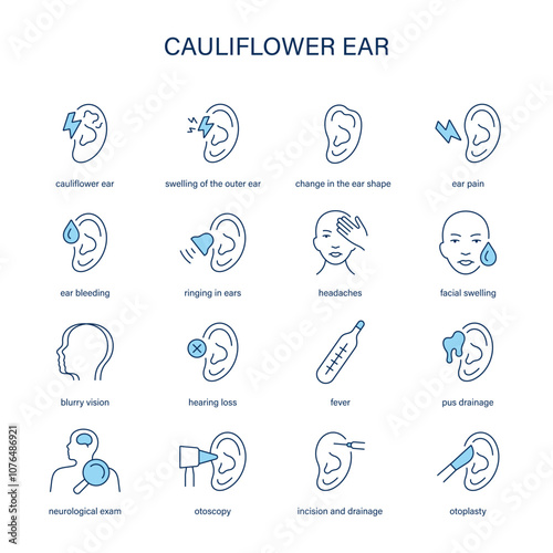 Cauliflower Ear symptoms, diagnostic and treatment vector icon set. Medical icons.