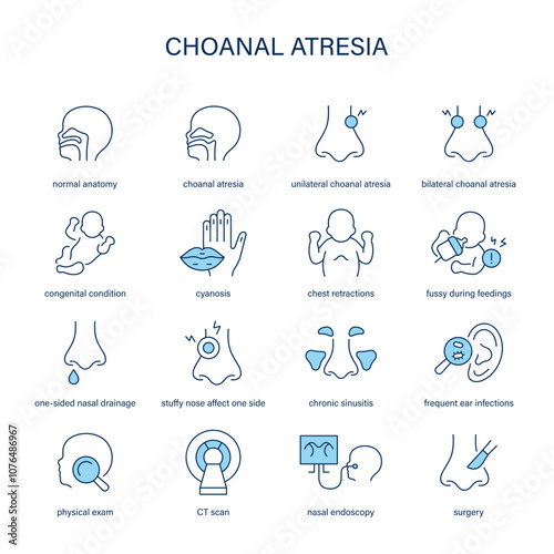 Choanal Atresia symptoms, diagnostic and treatment vector icon set. Medical icons.