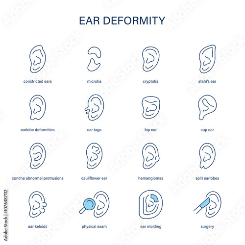 Ear Deformity symptoms, diagnostic and treatment vector icon set. Medical icons.