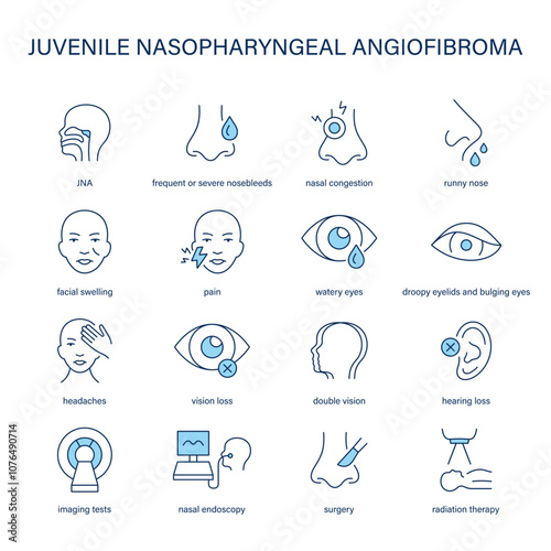 Juvenile Nasopharyngeal Angiofibroma symptoms, diagnostic and treatment vector icon set. Medical icons.