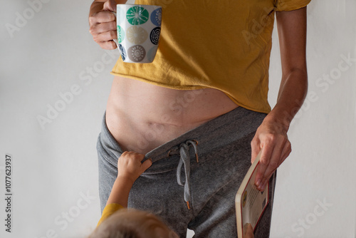 Mother with a cesarean section scar with a baby photo