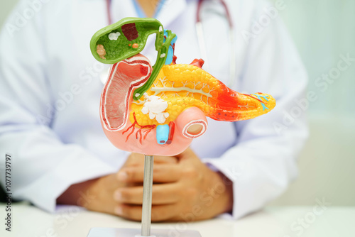 Pancreatitis, pancreatic cancer, Asian doctor with pancreas, gallbladder and bile duct human anatomy model at hospital. photo