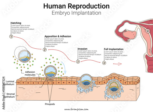 Embryo implantation Human Reproduction illustration with text