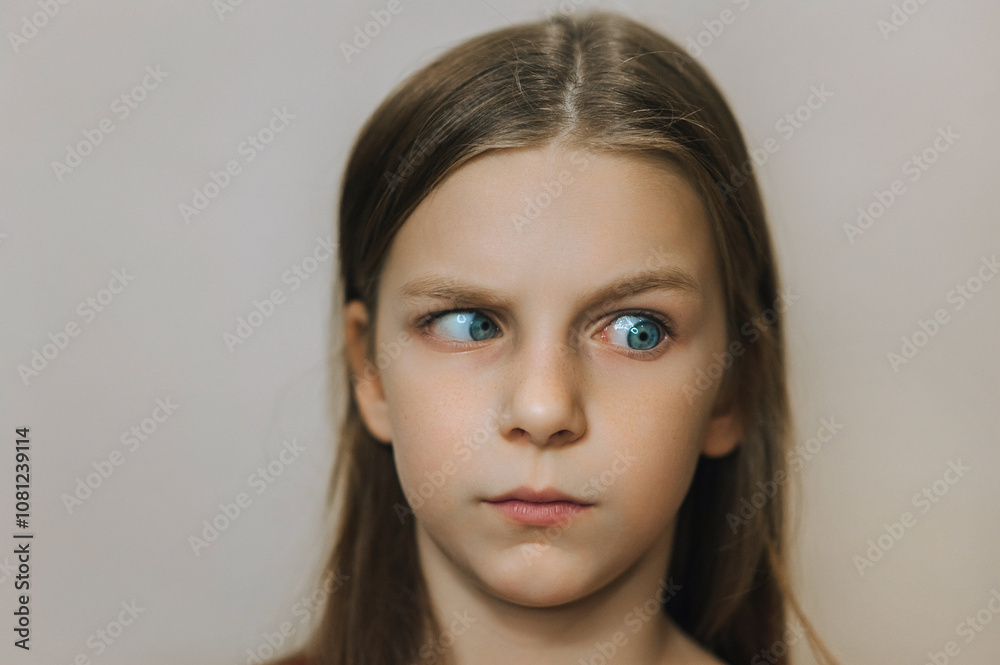 Photograph, portrait of a little sick girl, a child with strabismus, problems and eye disease. Photograph, portrait of a little sick girl, a child with strabismus, problems and eye disease.