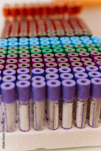 Organized colorful test tubes in a lab tray, ready for blood analysis and diagnostics photo