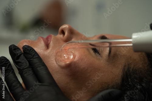 treatment with facial frequency in esthetic center photo