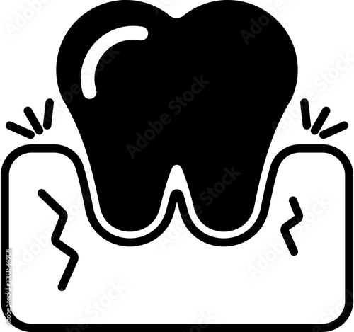 Gingivitis