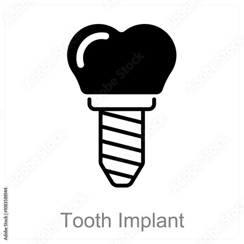 Tooth Implant