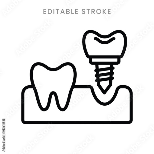 Dental implant treatment icon. Teeth implants surgery procedure symbol outline icon. Editable stroke