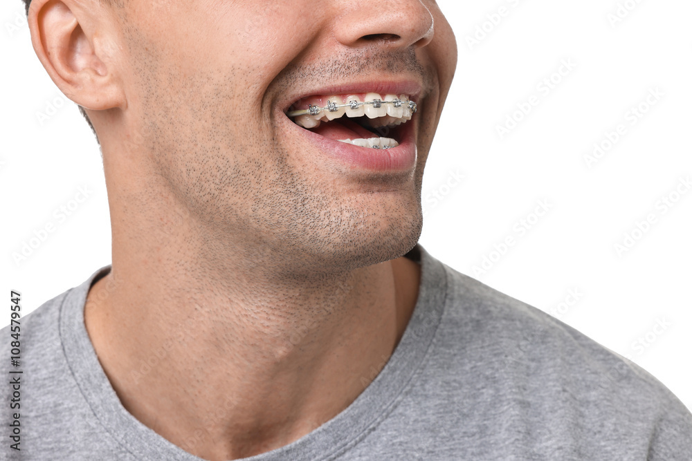 Obraz premium Happy man with dental braces on white background, closeup