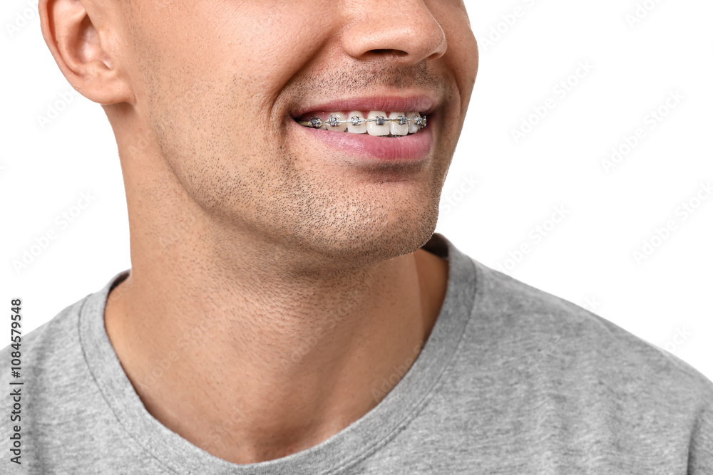 Fototapeta premium Smiling man with dental braces on white background, closeup