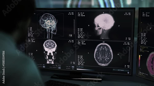 Doctor monitoring the x-ray analysis of the ill persons head. Doctor controlling the x-ray analysis procedure at the healthcare clinic. Doctor diagnosing the brain damage after an x-ray analysis.