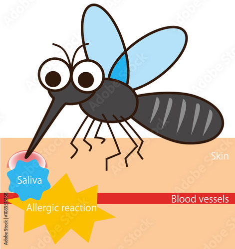 mosquito déformer Bloodsucking　figure