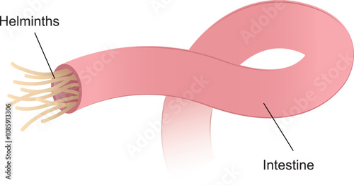 Illustration of internal human parasites, roundworm or hookworm in the small intestine
