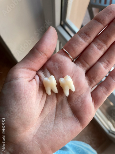 Close-up of a hand holding two freshly extracted wisdom teeth, showcasing their detailed structure against a background of natural indoor light. A unique and raw depiction of human anatomy