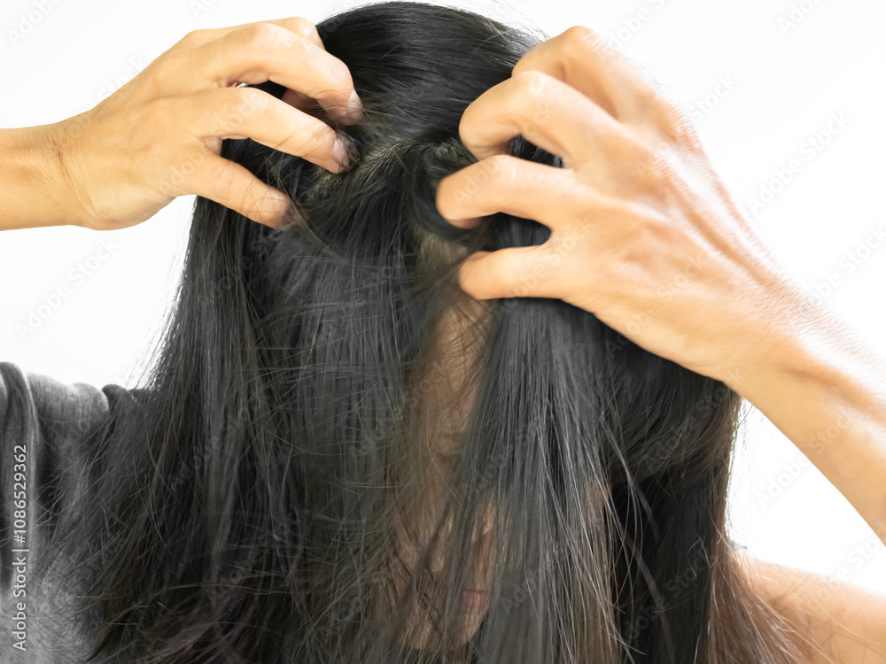 Naklejka premium Dandruff Itchy scalp, woman chtatch hair messy she dirty, sensitive disease bacteria dander loss, concept for medicine hyginene champoo treatment skin for good health.