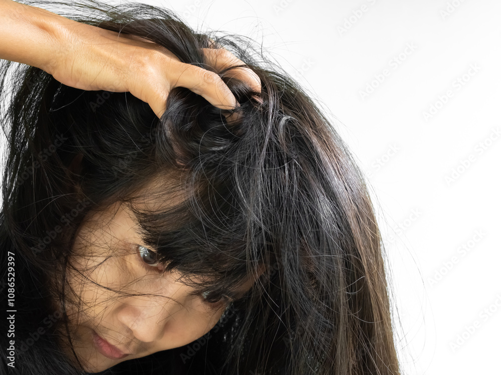 Fototapeta premium Dandruff Itchy scalp, woman chtatch hair messy she dirty, sensitive disease bacteria dander loss, concept for medicine hyginene champoo treatment skin for good health.