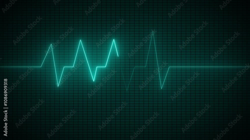 eartbeat monitor animation A smooth animation in high quality on a heart rate monitor in a hospital environment.Abstract cyan neon heartbeat and pulse rate signal technology animated. eartbeat monitor animation A smooth animation in high quality on a heart rate monitor in a hospital environment.Abstract cyan neon heartbeat and pulse rate signal technology animated.
