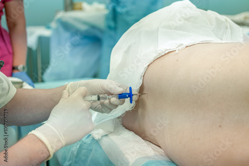 Doctor anesthesiologist puts anesthesia in the back of a woman in the operating room