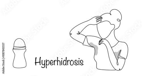 Hyperhidrosis