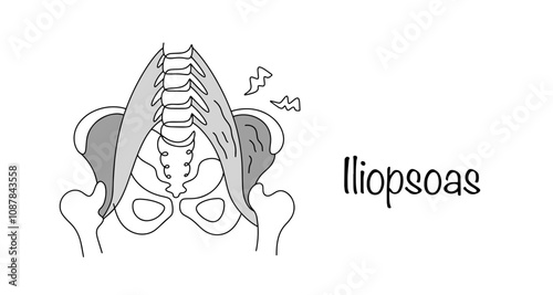 Iliopsoas