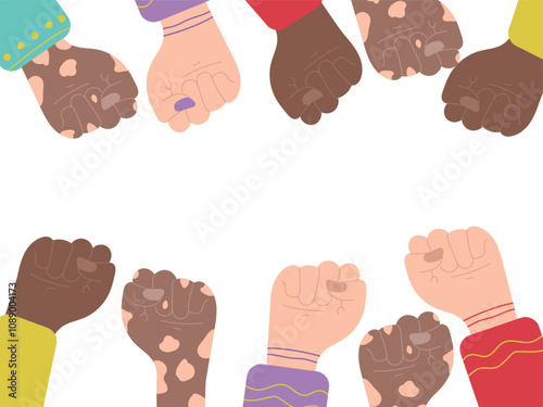 Fists raising up as a symbol of protest for human rights. Concept of diversity, racial conflicts, vitiligo disease. Hand drawn vector illustration in flat style. Human hands up, agitation, elections
