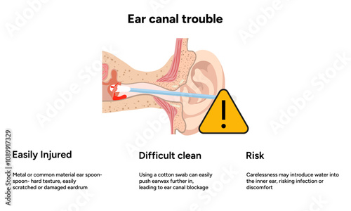 The reason not to use q-tip for earwax removal. Ear canal trouble. Medical information