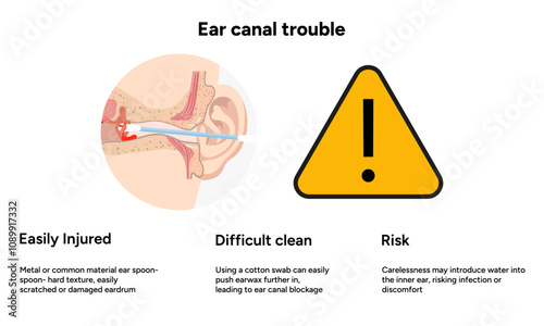The reason not to use q-tip for earwax removal. Ear canal trouble. Medical information