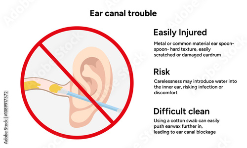 The reason not to use q-tip for earwax removal. Ear canal trouble. Medical information