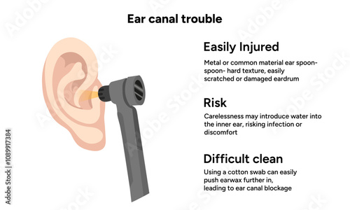 The reason not to use q-tip for earwax removal. Ear canal trouble. Medical information
