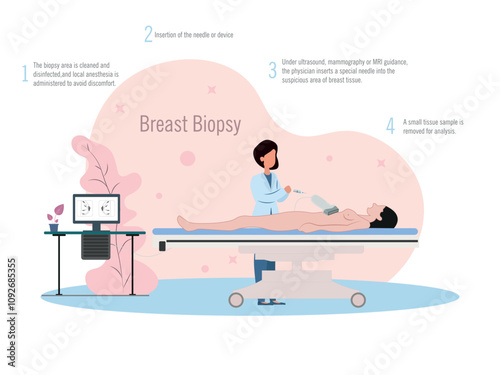Breast biopsy procedure.Medical illustration showing the steps of a breast biopsy, including anesthesia and tissue extractionmografia