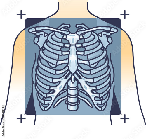 Illustration of a ribcage X-ray, highlighting the skeletal structure of the chest.