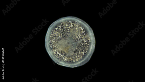 Coral larva under a microscope, order Actiniaria, phylum Cnidaria, adult stage, will soon sink to the bottom and turn into a coral polyp. Atlantic Ocean