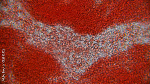 Human blood under a microscope. You can see erythrocytes - red blood cells. The red color is given to them by the ferrous atom of iron, which is able to bind oxygen.